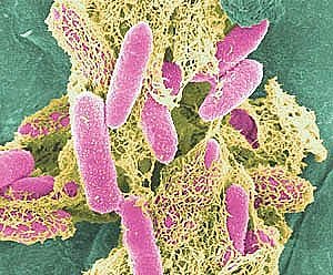 E. coli Google image from http://www.healthline.com/blogs/outdoor_health/uploaded_images/Ecoli%5B1%5D-726771.jpg