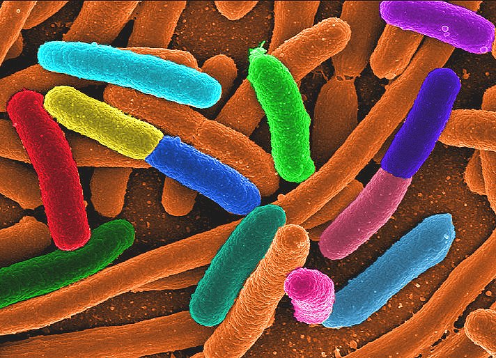 Diverse E. coli Google image from http://zoonotica.files.wordpress.com/2011/06/diverse_e_coli.png