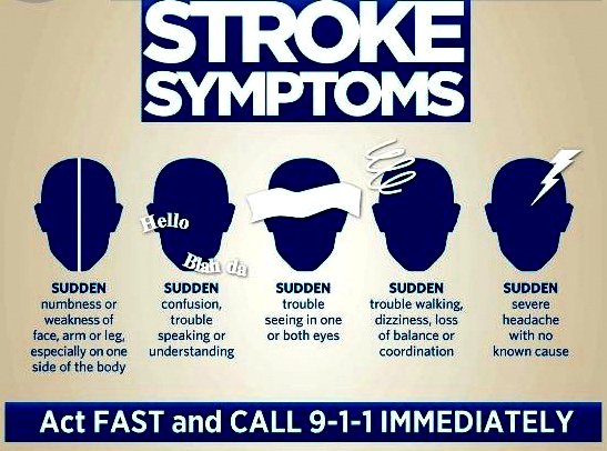 Stroke Symptoms Google image from https://salvagente.co.za/ozone-saunas/stroke-ozone-therapy/